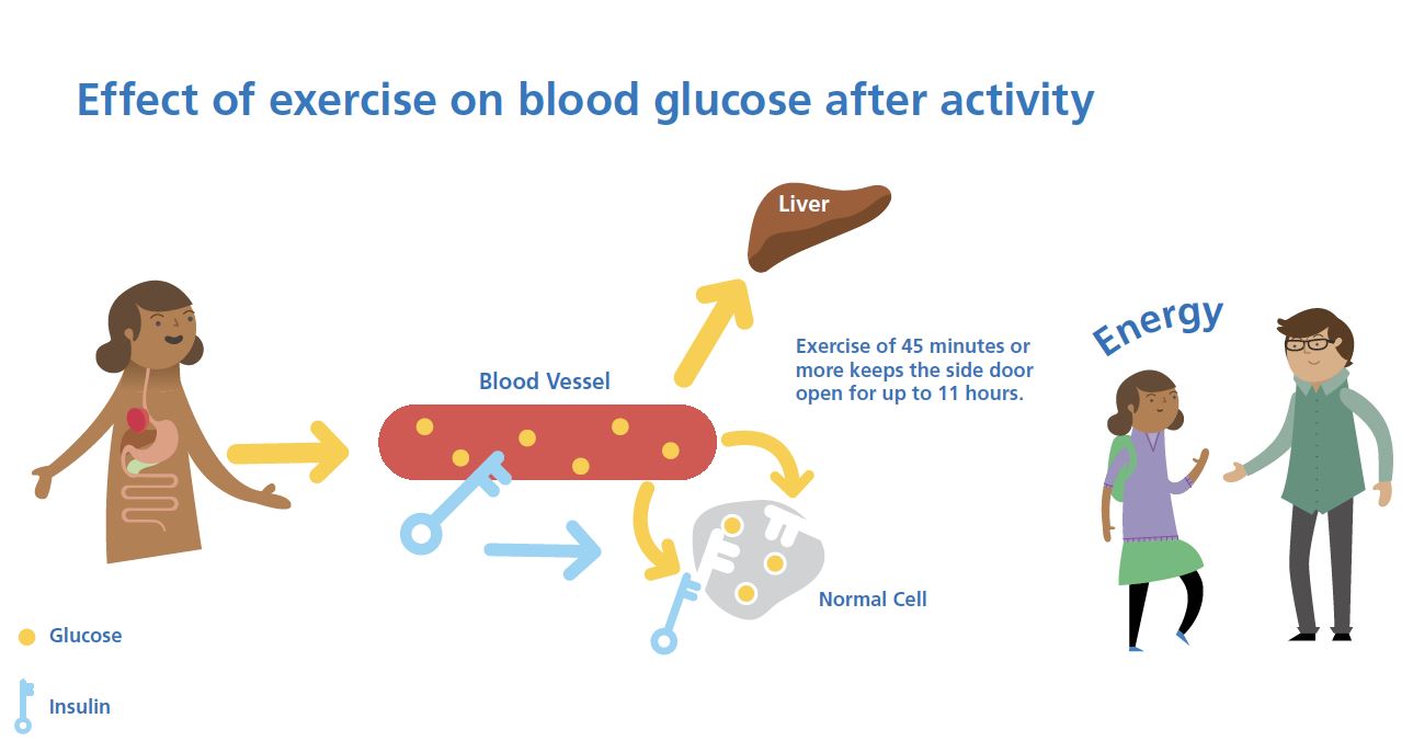 CGM trace showing delayed hypoglycaemia risk following longer aerobic exercise sessions