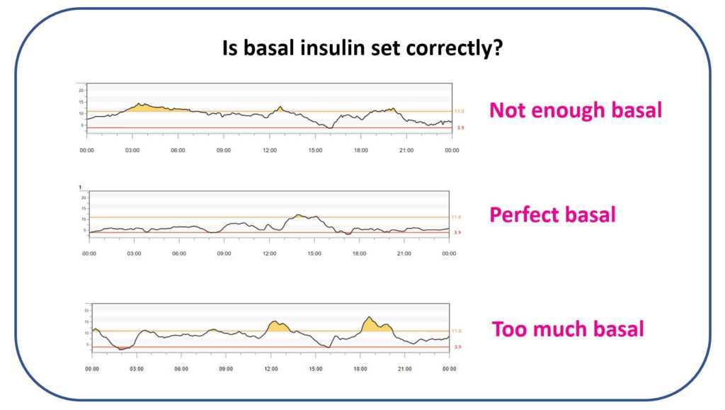 Example CGM trace showing glucose remaining broadly stable overnight, illustrating what well-matched basal insulin often looks like.