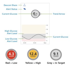 Example CGM receiver screen showing a current glucose reading and a trend arrow.