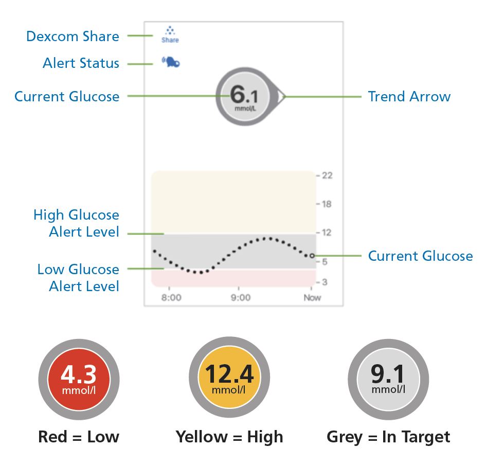 Example CGM receiver screen showing a current glucose reading and a trend arrow.