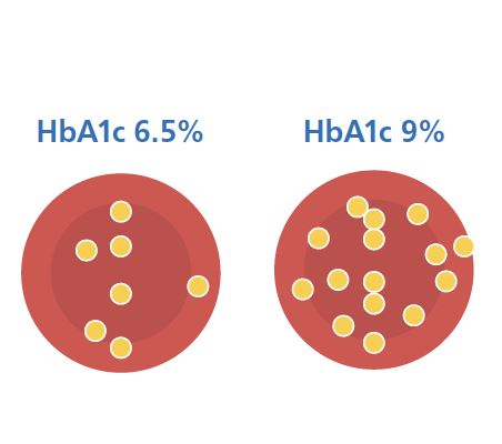 Diagram illustrating HbA1c as glucose molecules attached to red blood cells, reflecting average glucose over approximately three months.