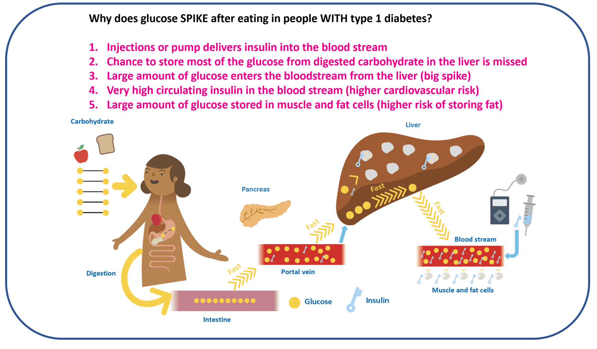 Diagram comparing portal insulin delivery in people without diabetes versus injected insulin in type 1 diabetes