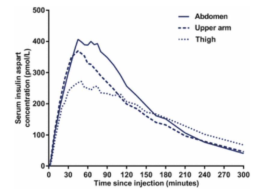 Illustration showing relative insulin absorption speed by injection site: abdomen absorbs fastest, then upper arm, then outer thigh.
