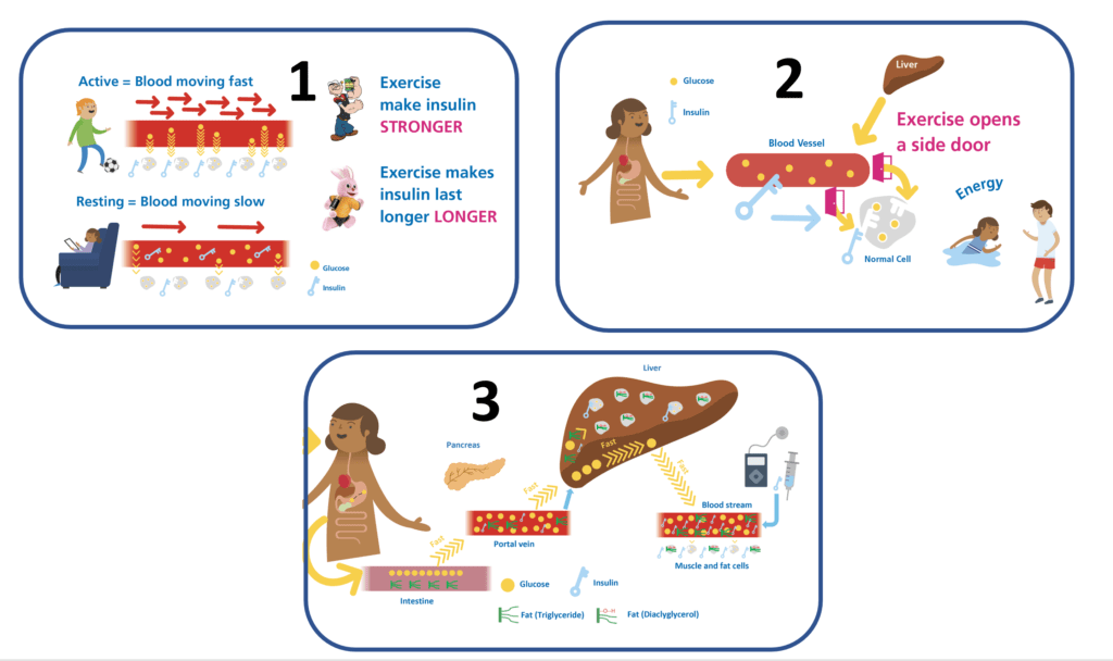 Chart showing the glucose-lowering effect of post-meal exercise in type 1 diabetes
