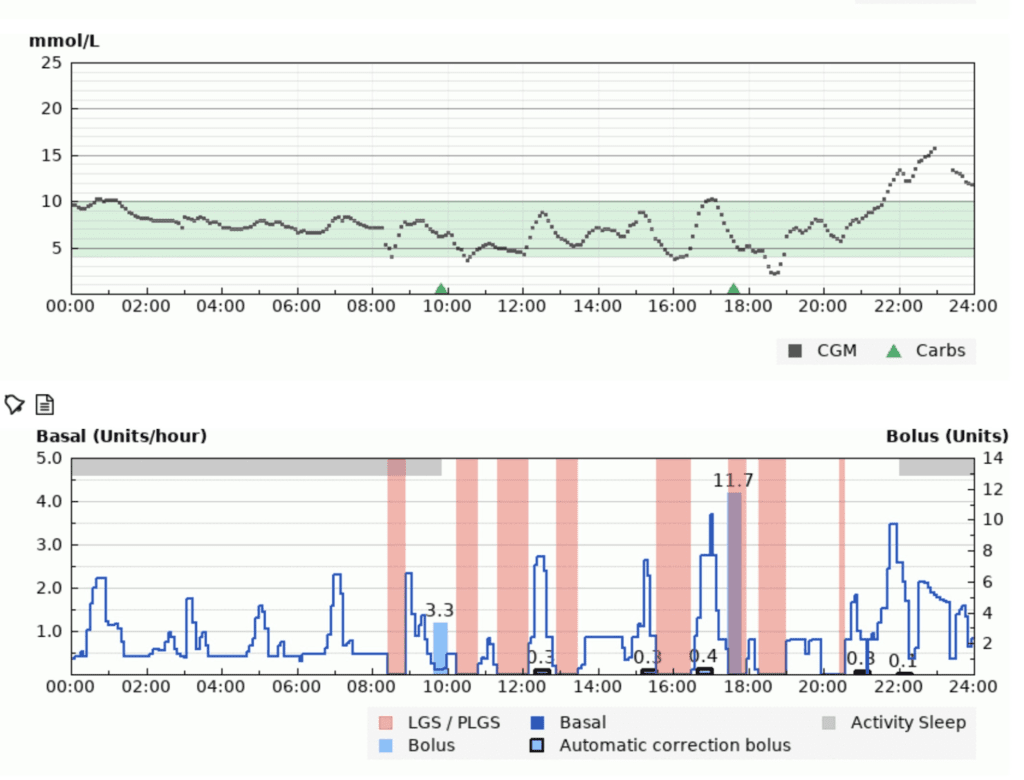 How AID systems work: the algorithm adjusts insulin based on CGM readings over time