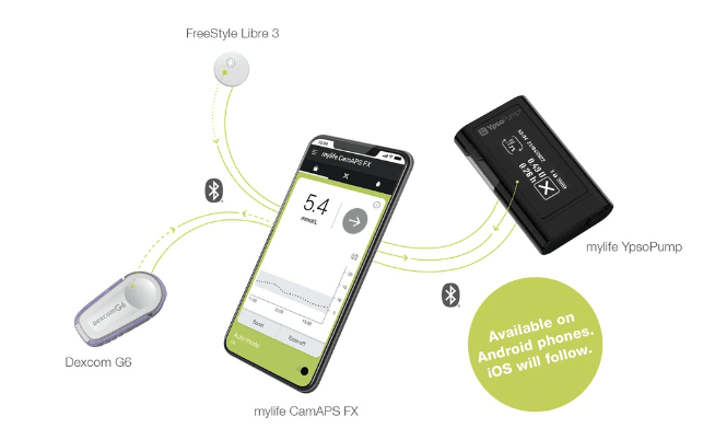 CamAPS FX system overview showing the four components working together