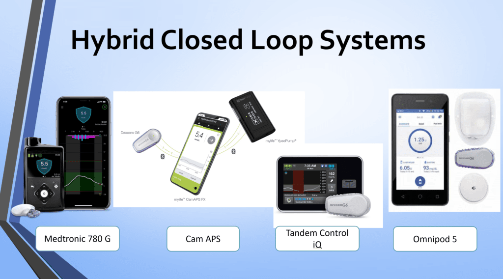Current commercially available AID systems in the UK as of January 2026