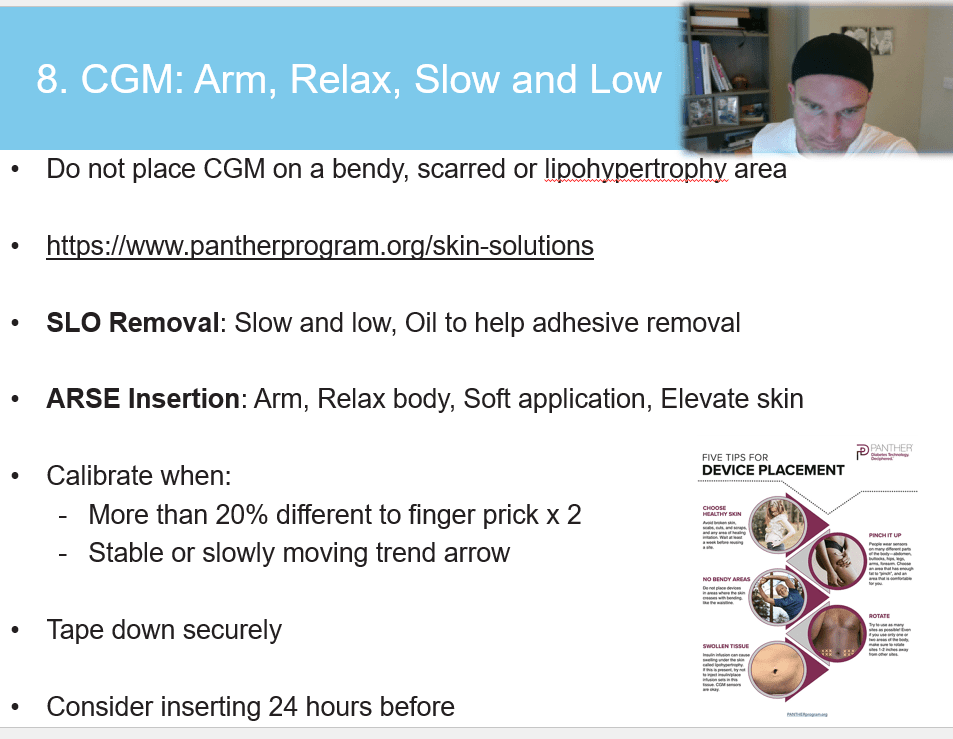 SLO ARSE CGM insertion guide showing the six-step technique for optimal sensor placement