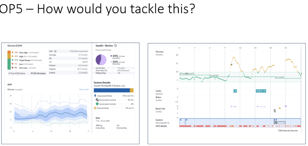 Omnipod 5 before settings adjustment — evening glucose profile in under-5s — The Glucose Never Lies®