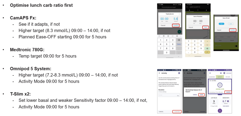 AID system options for managing midday hypoglycaemia in under-5s with type 1 diabetes — The Glucose Never Lies®