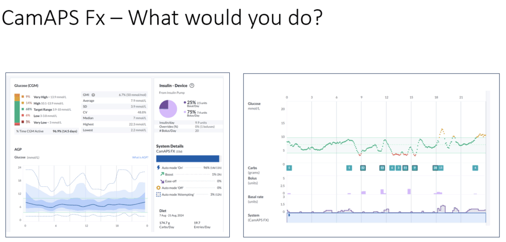 CamAPS FX before settings adjustment — evening glucose profile in under-5s — The Glucose Never Lies®