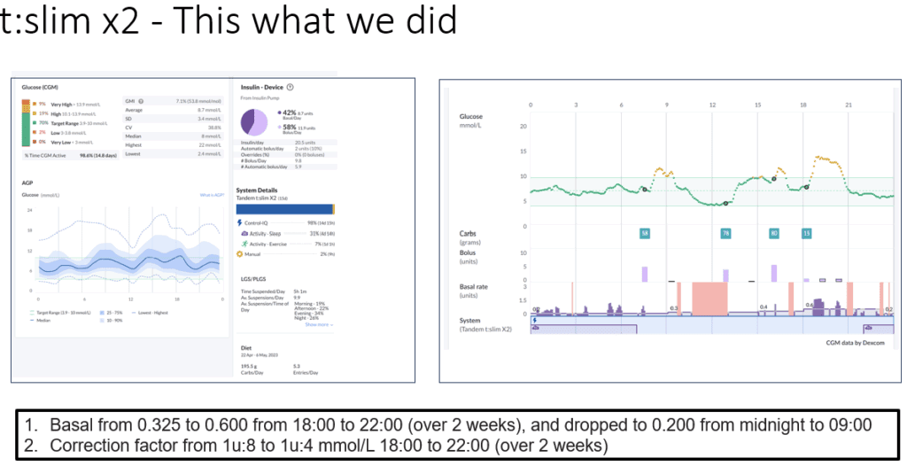 t:slim X2 Control-IQ after settings adjustment — improved evening glucose profile in under-5s — The Glucose Never Lies®