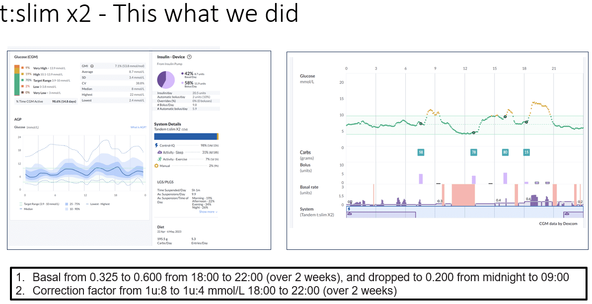t:slim X2 Control-IQ evening profile after windowing Sleep Mode to the overnight phase