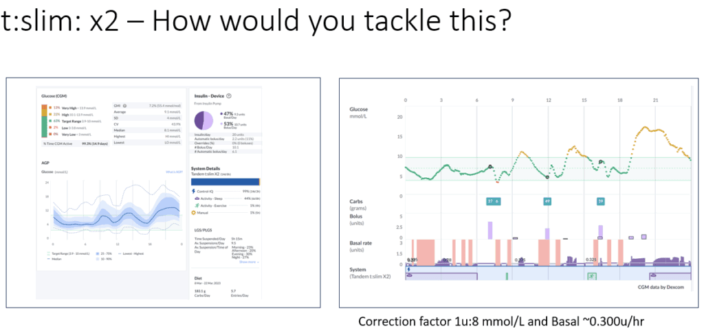 t:slim X2 Control-IQ before settings adjustment — evening glucose profile in under-5s — The Glucose Never Lies®