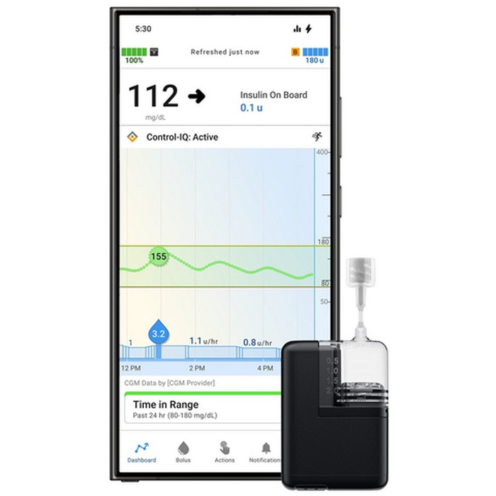 Tandem Mobi pump with infusion line alongside the t:connect mobile app showing glucose trace and insulin on board
