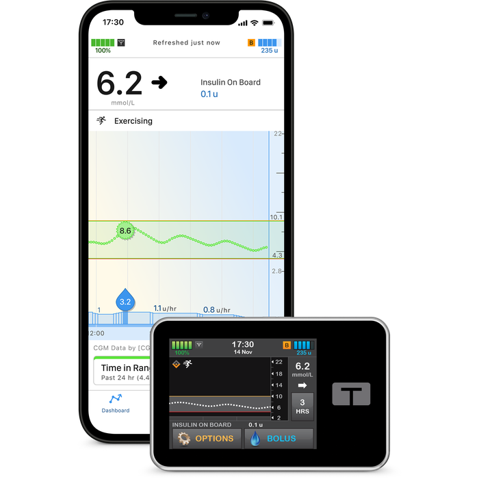 Tandem t:slim X2 pump alongside the t:connect mobile app showing glucose trace and insulin on board